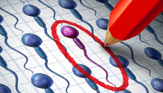 Sperm Donasyonu Sperm Donasyonu
